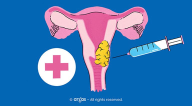 Screening și metode de tratament în cazul cancerului de col uterin